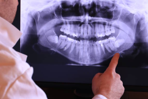 Best Urgent Care for Lost Fillings or Crowns in Salem, IN