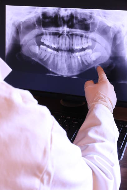 Best Emergency Tooth Extraction in Salem, IN
