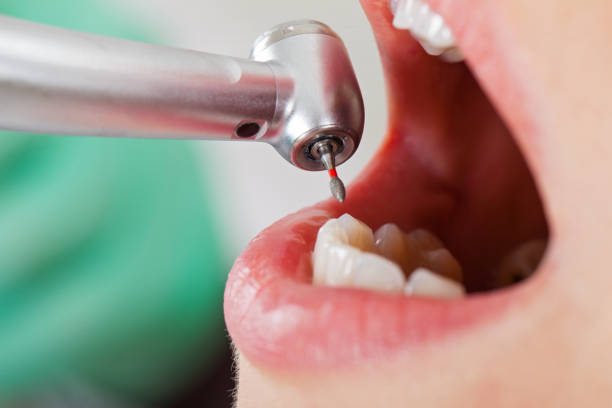 Best Emergency Gum Treatment in Salem, IN